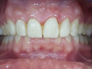 Zahnarztpraxis für Veneers in Bielefeld